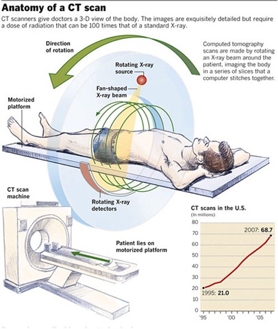 anatomy_of_a_CT_scan