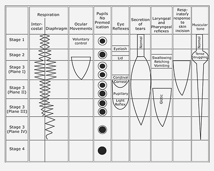 ana_2_113_conduct_of_inhalational_induction-_07_t2_med